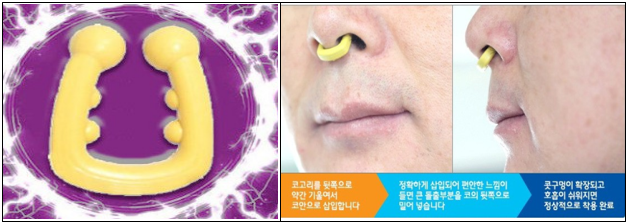 이유 2번째 이미지